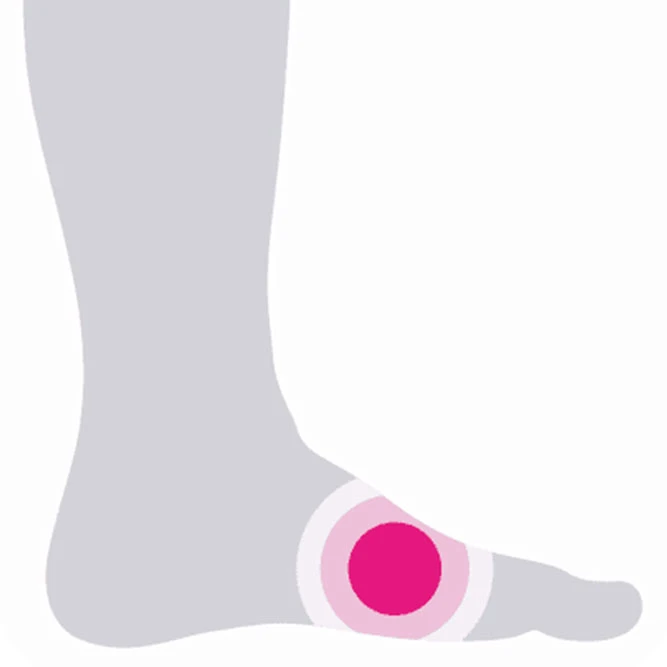Bild_Loesungen_Diabetes_Fuss