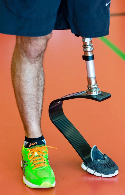 sportprothesen-201507-3.jpg